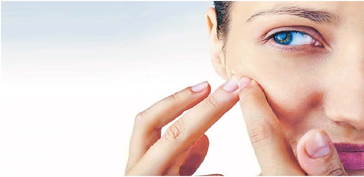 is it ok to pop your pimples?
