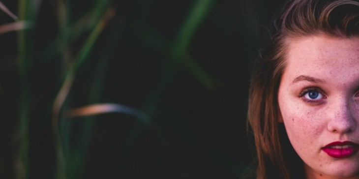 How to treat hyperpigmentation on your skin?