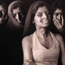 Redefining beauty through the eyes of Acid Attack survivors!